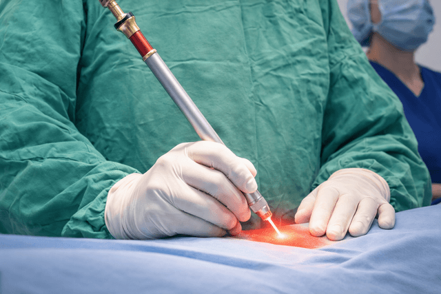 Laser Surgery